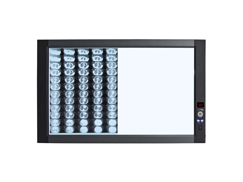 Visor de película de rayos X LED (Modo de luz lateral)