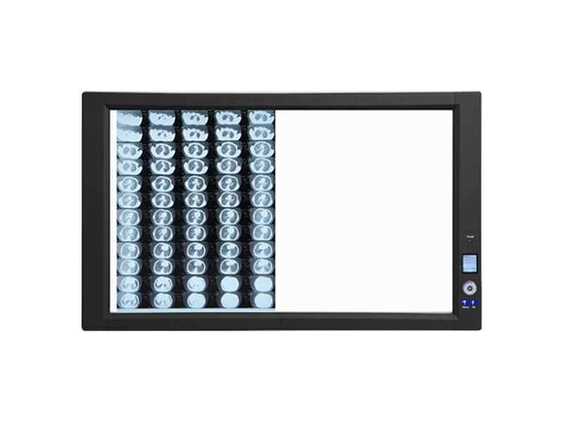 Visor de película de rayos X LED ultrabrillante(Modo de luz de fondo)